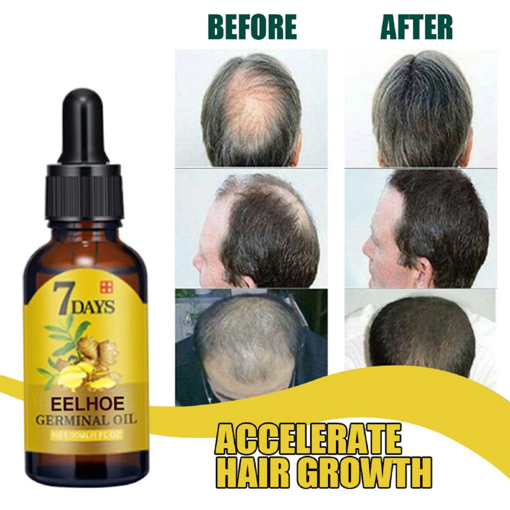 Cuidado Del Cabello Con Jengibre